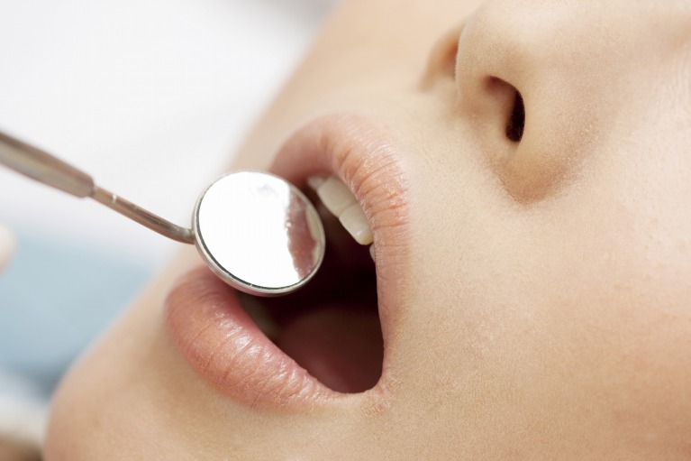 虫歯のことをちゃんと知ろう